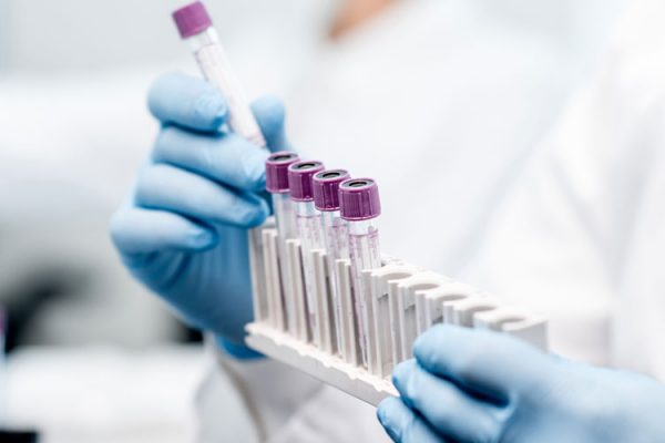 high complexity medical laboratory – Lab Testing Matters