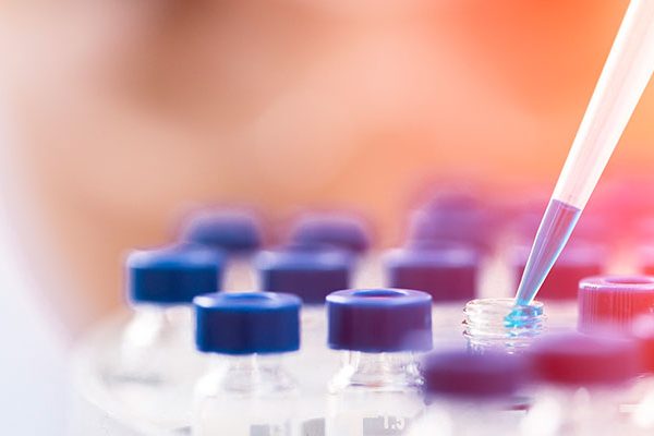 Stories From The Front Line Of The Lab The Impact Of My Lab Error