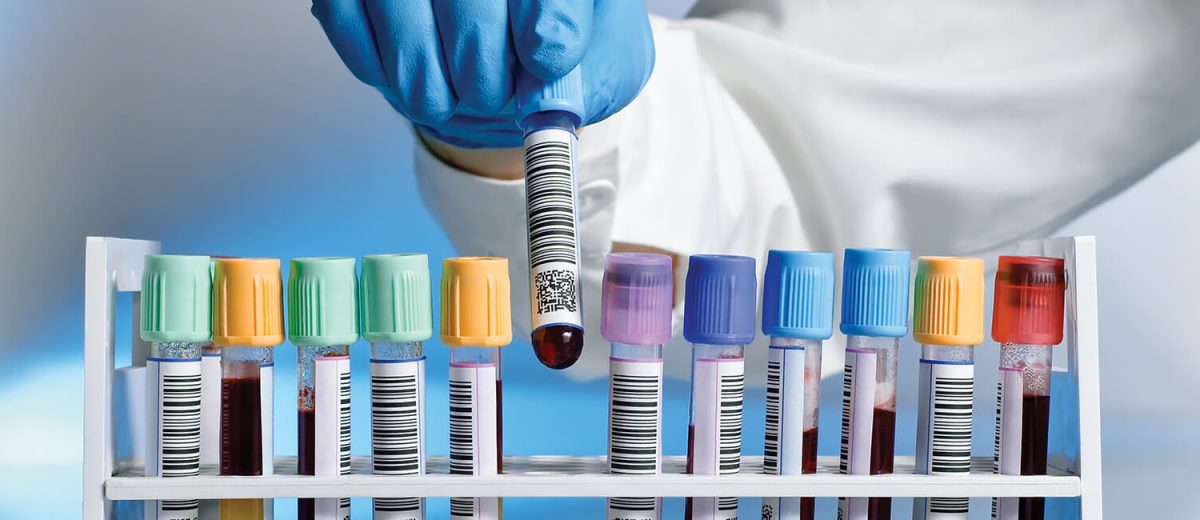 The Hidden Profession that Saves Lives Every Day – Medical Laboratory Science! – Lab Testing Matters